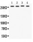 Anti-Notch1 Antibody